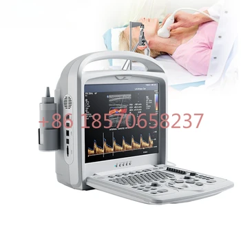 farebný doppler CE digitálne prenosné farba dopplerov ultrazvuk zdravotnícke zariadenia/lacné dopplerov ultrazvuk stroj skener cenu